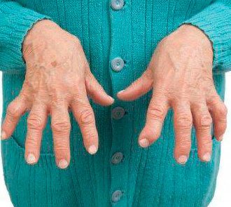 Бўғим касалликлари фалажлик ва ногиронликка олиб келади!