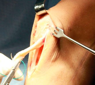 Бўғим касалликлари фалажлик ва ногиронликка олиб келади!